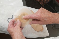 Ak je vaša stómia nerovná či oválna, prispôsobte otvor v lepiacej ploche vrecka na požadovanú veľkosť malými ostrými nožnicami, alebo použite končeky prstov na vyrovnanie otvoru.