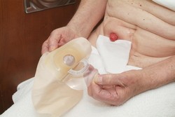 Těsně před nasazením sáčku z něj odstraňte ochrannou fólii.