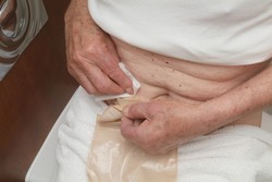 Jemně odstraňte použitý sáček. Prosím nezapomeňte, že sáček je nutno vyprázdnit předtím, než začnete. Jako dodatečné preventivní opatření, a abyste se vyhnuli ušpinění, můžete k vašemu opasku připevnit sáček na odpadky.