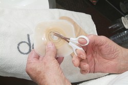 Zapamatujte si, že je důležité, aby velikost otvoru odpovídala vaší stomii a to bez použití tlaku.