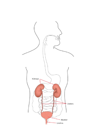 Urostomie