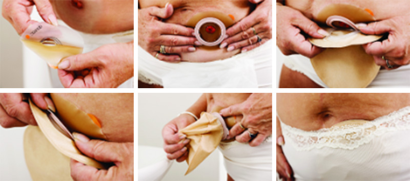 Aplikace podložky a sáčku