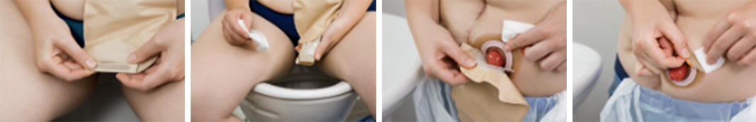 Vyprázdnění a odstranění sáčku