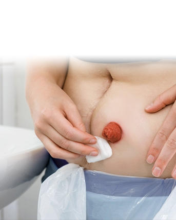 Návod na výměnu pomůcky