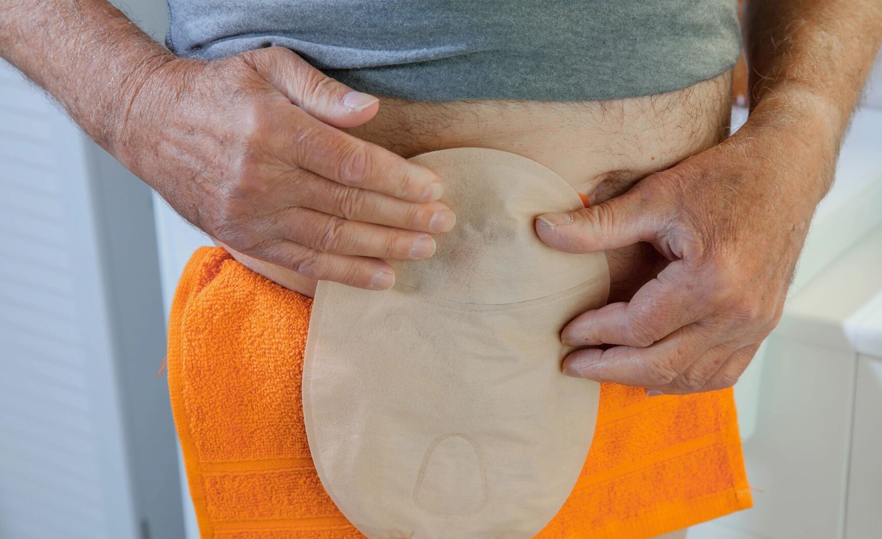 Pocení a ochlupení