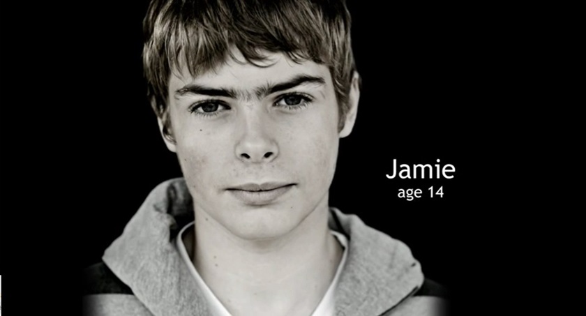Jamie, kolostomie od roku 2005