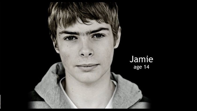 Jamie kolostómia od roku 2005